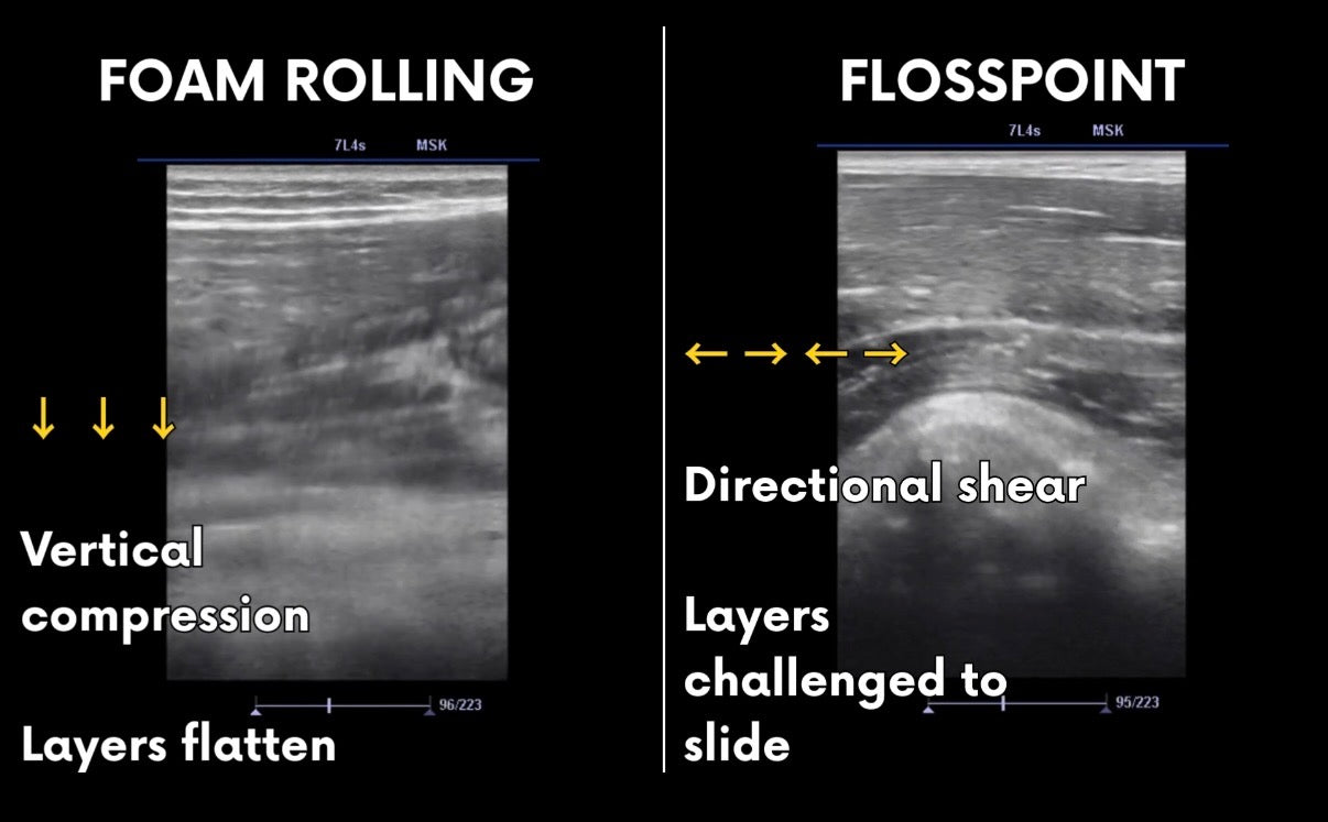 MSK ultrasound comparison showing foam rolling vertical compression versus FlossPoint directional shear at tissue interfaces during movement