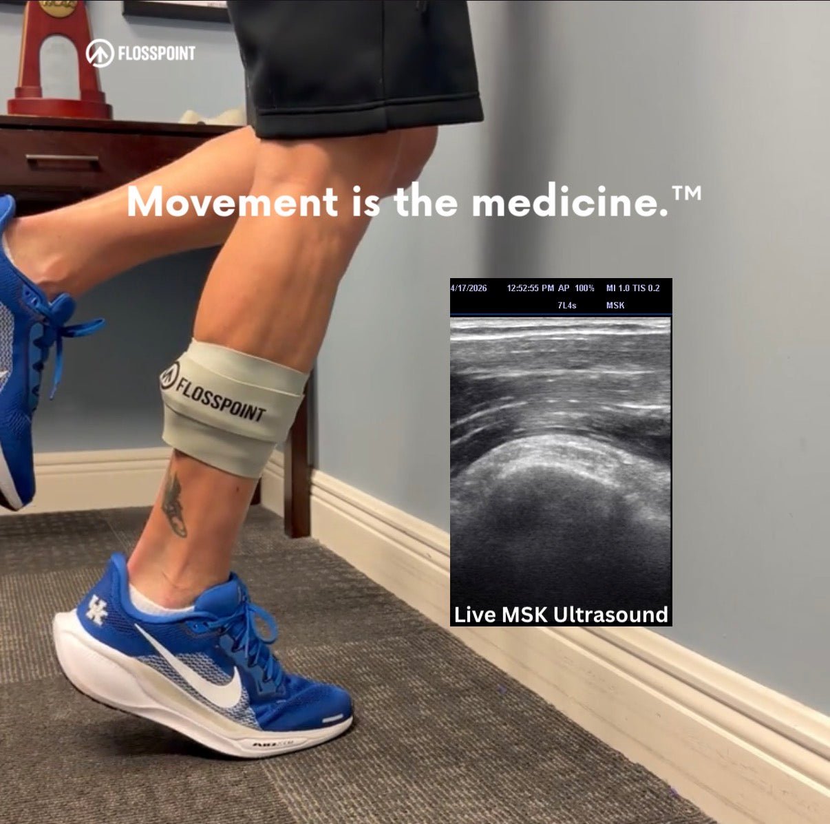Achilles Tendinopathy: What Actually Works — and Where the Calf Comes In | FlossPoint