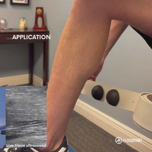 FlossPoint band with ShearPoints applied to calf during loaded movement — live MSK ultrasound showing directional shear at tissue interfaces

